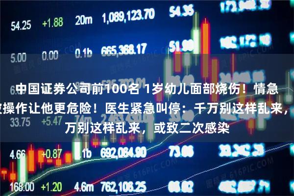 中国证券公司前100名 1岁幼儿面部烧伤！情急之下 大人一波操作让他更危险！医生紧急叫停：千万别这样乱来，或致二次感染